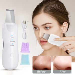 Skin Scrubber Face Cleaning Machine